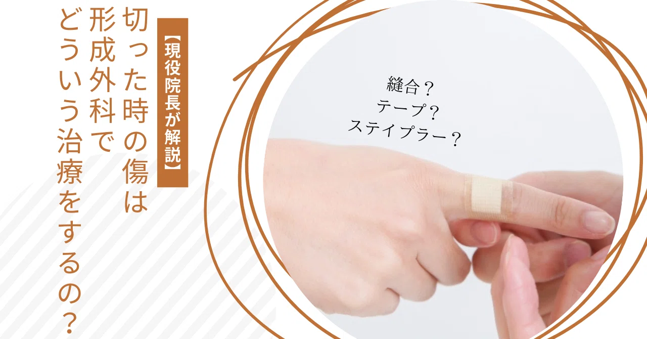 現役院長が解説】切った時の傷は形成外科でどういう治療をするの