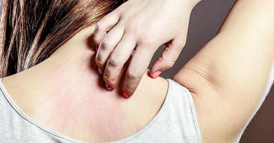 ファモチジンを併用すると フェキソフェナジンの効果は増強する 薬備 ヤクビ 保険薬局薬剤師のアカデミック備忘録 鎌田貴志 Note