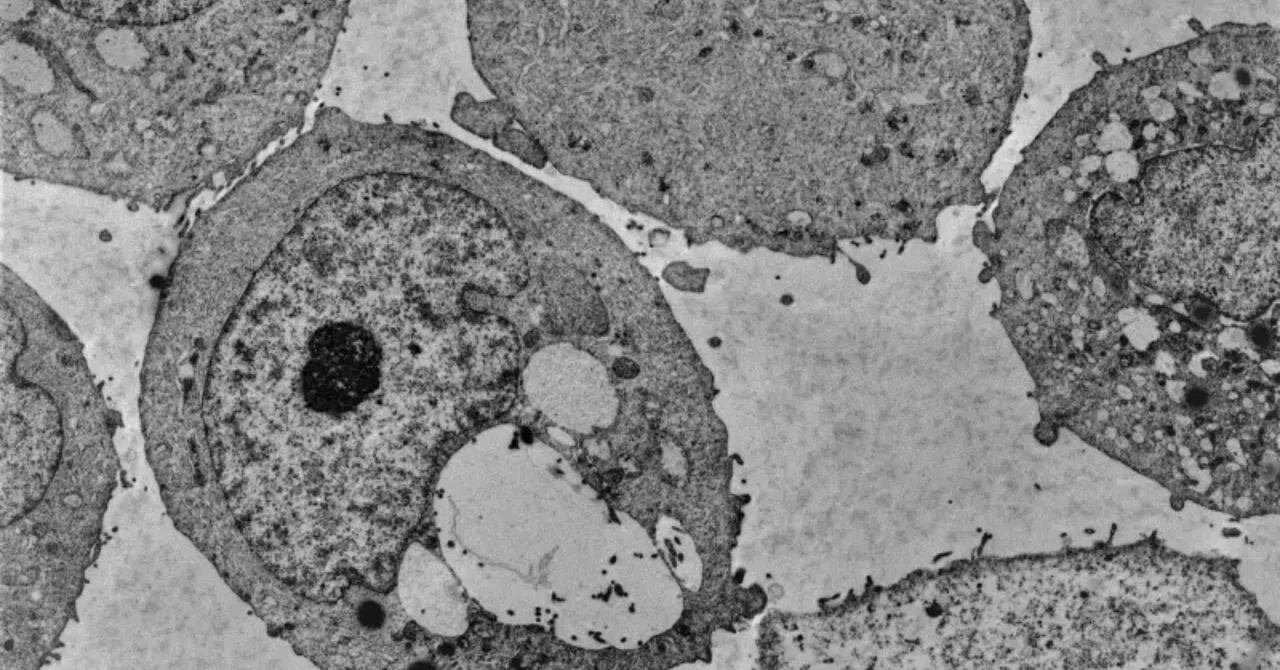 最新：研究者らが、ビタミンKサプリメントがマウスの前立腺がんの進行を遅らせることを発見