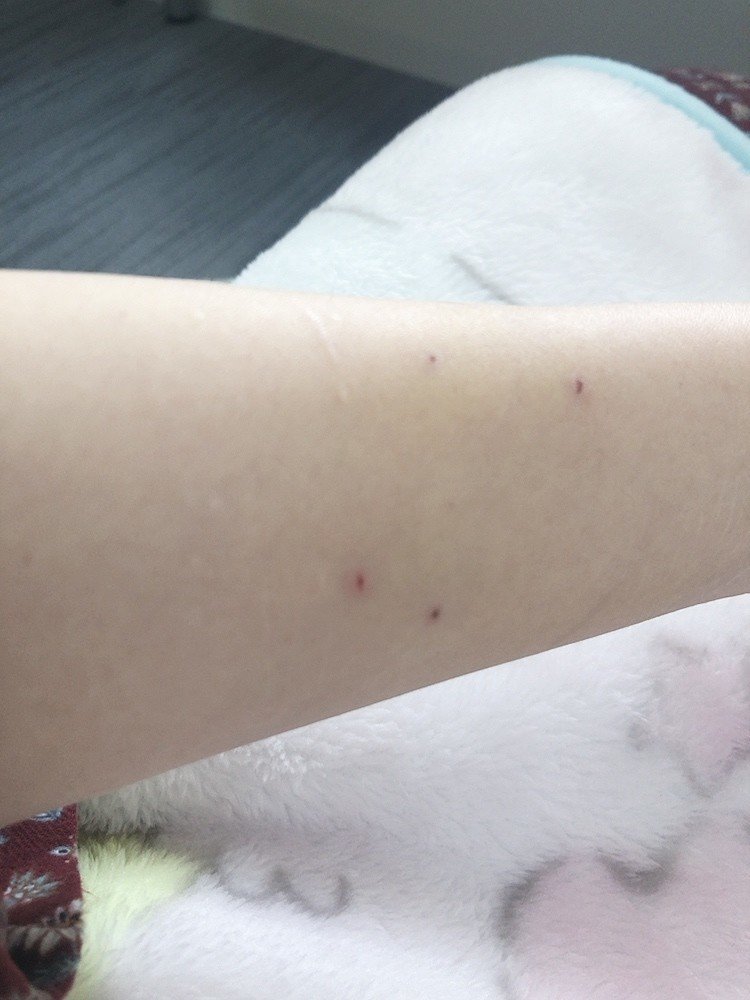ねこに噛まれただけ と侮ってはいけない話 みきちむ Note ねこに噛まれただけ と侮ってはいけない話 みきちむ Note