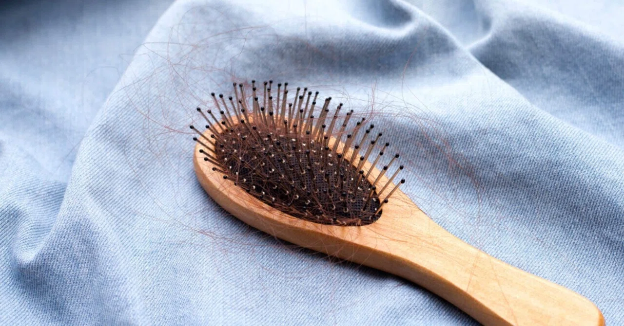 最新｜ビタミンD欠乏に関連する脱毛症のタイプは？システマチックレビューとメタ解析