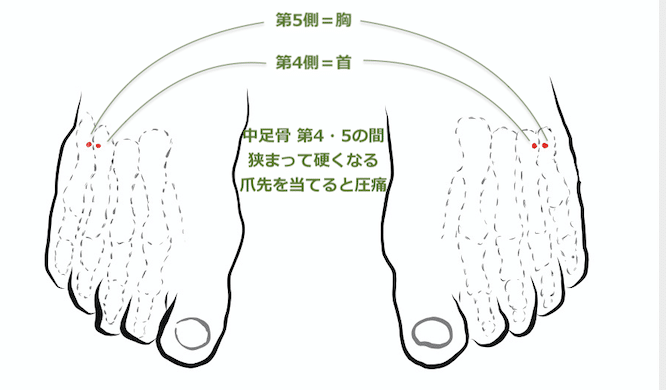 2019.8-9月 4・5 中足骨2