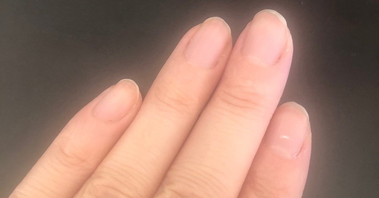 幸運の兆し 爪に白い斑点 Kozue Note 幸運の兆し 爪に白い斑点 Kozue Note