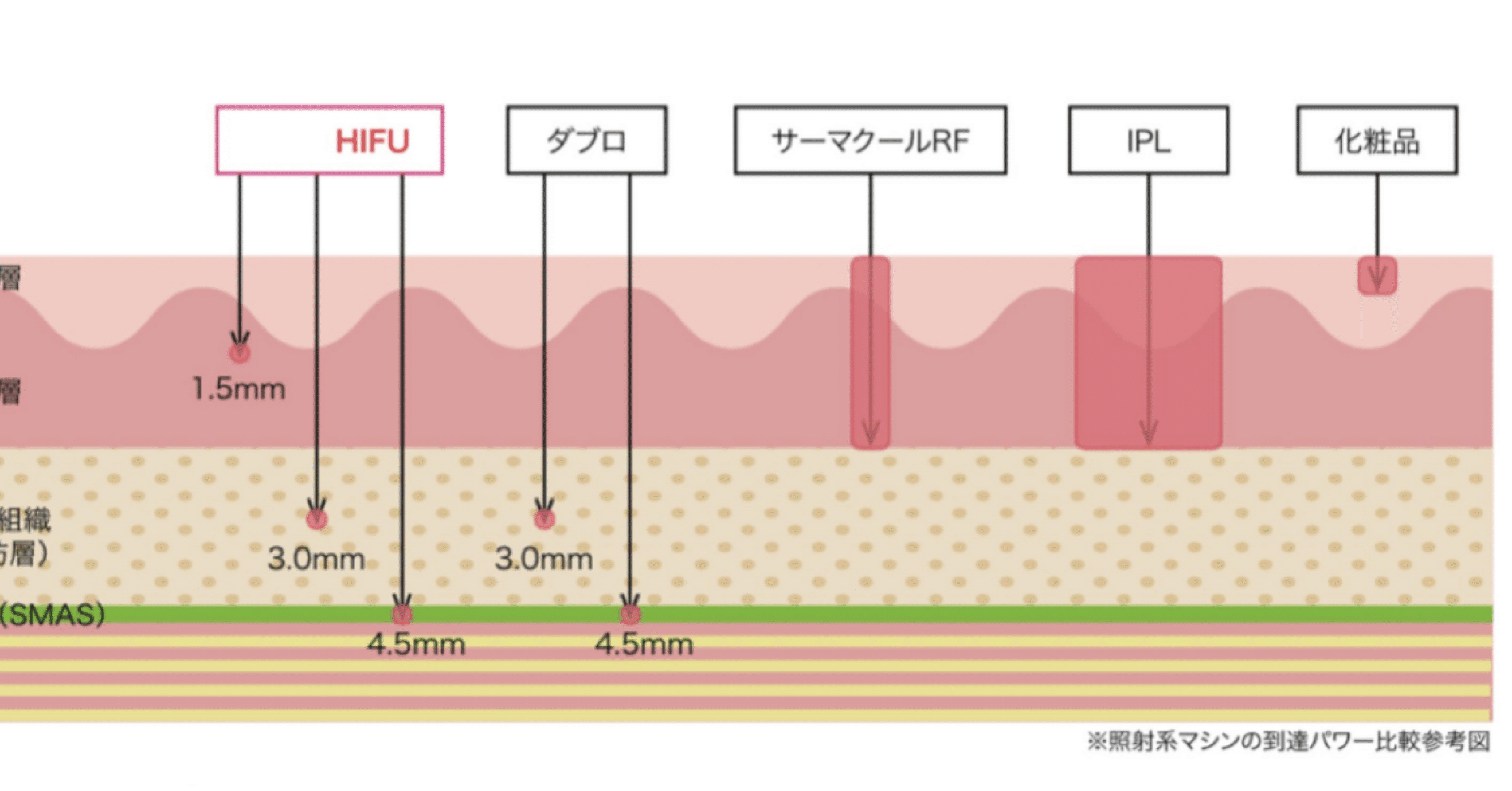 次世代サーマクール サーモリフト 業務用 ✴︎エステ 次世代