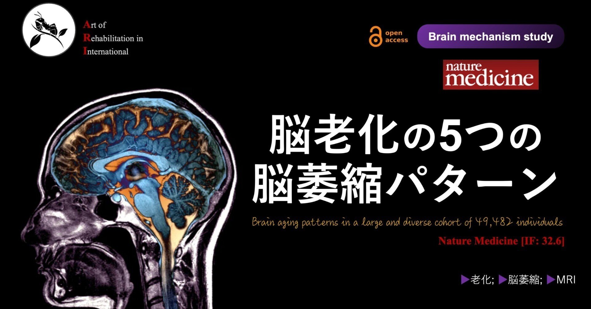 脳老化の5つの脳萎縮パターン|Super Human | 理学療法士/保健 脳老化の5つの脳萎縮パターン|Super Human | 理学療法士/保健