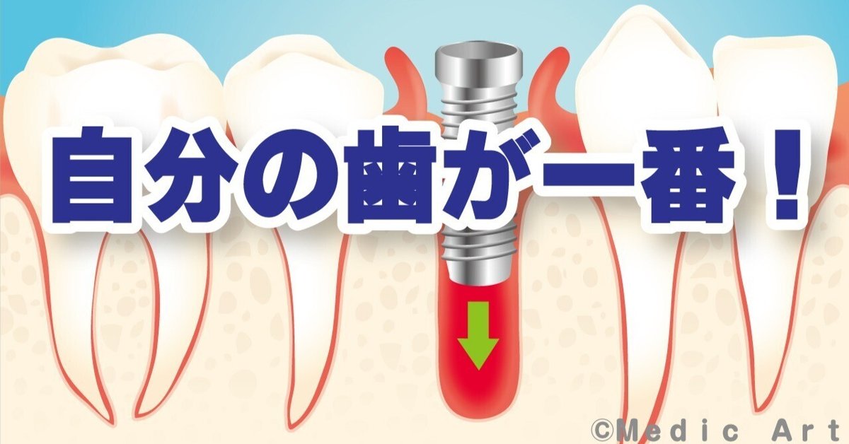 8本の歯を失った私が、2度のインプラントトラブルで気づいた天然