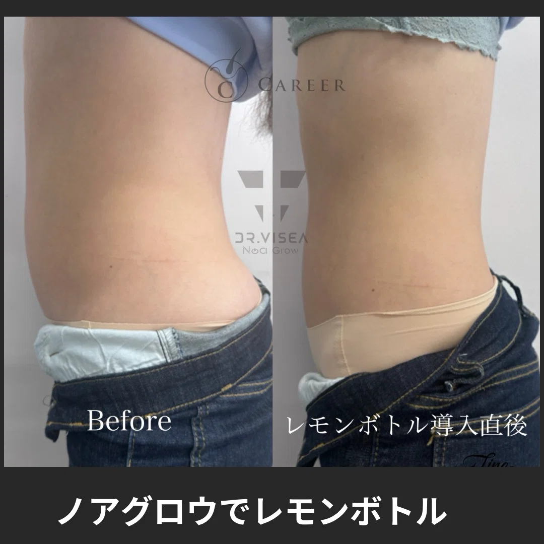 ノアグロウ✖︎レモンボトル 直後でこの効果は凄すぎて🥹我ながら凄い
