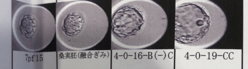 胚盤胞になれなかった卵子 私は人目もはばからずわんわん泣いた みくまゆたん Note 胚盤胞になれなかった卵子 私は人目もはばからずわんわん泣いた みくまゆたん Note
