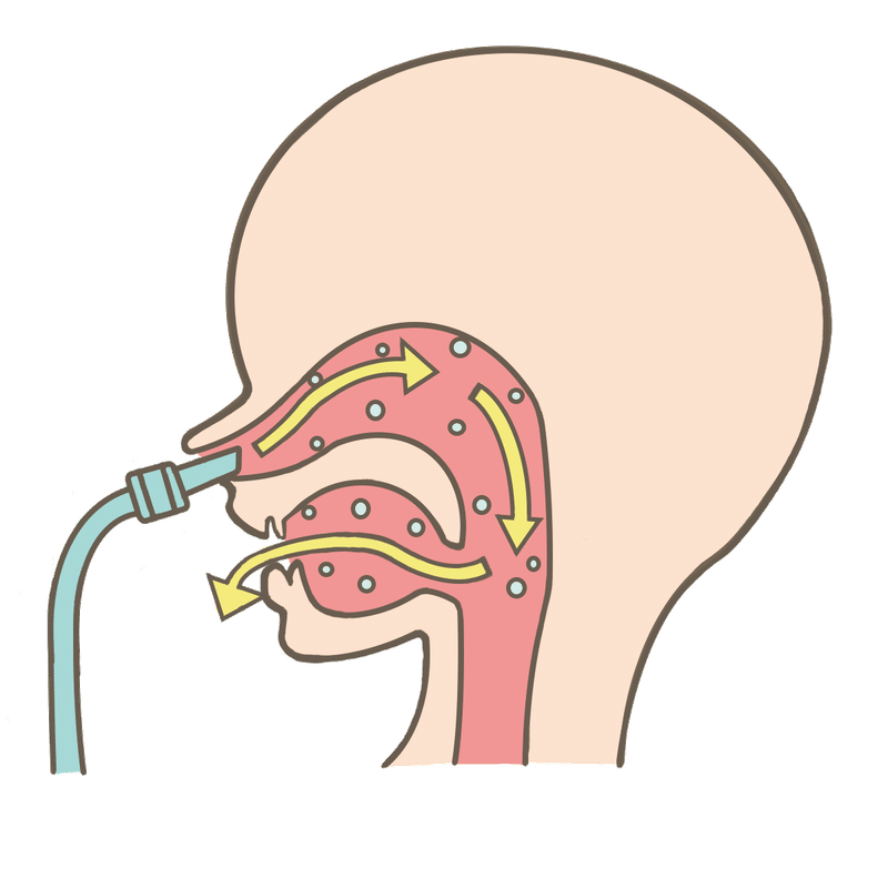 出 鼻 から ない 口 うがい 親知らずの抜歯後、口から鼻に空気が漏れている感覚がある。