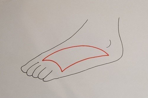 足底筋膜炎とアーチの関係