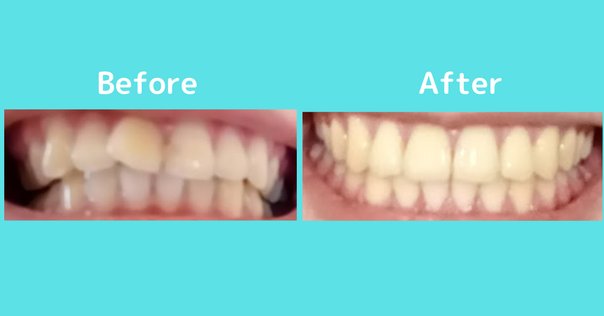  特価ブログのポータルサイト 矯正学｜Dentalobo 健康・医学