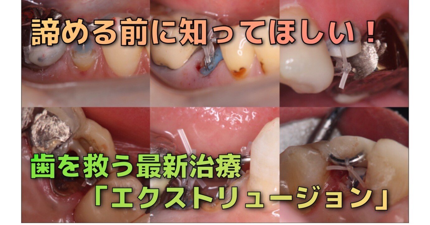 df15ddf86af661e032bd71354de8a9