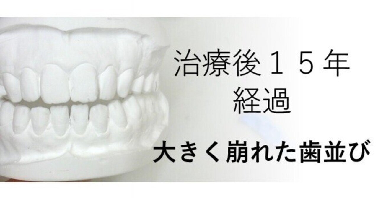 自分の歯列矯正に失敗した歯医者の私が20年かかってわかったこと