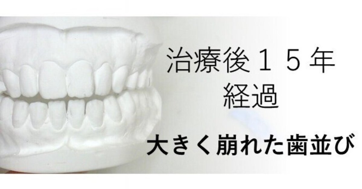 歯列矯正治療の失敗と再治療 歯列矯正治療の失敗と再治療: 臨床現場からのレポート | 菅原