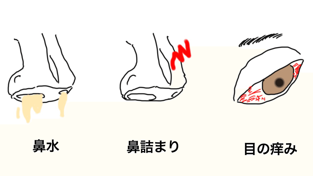 花粉症による症状