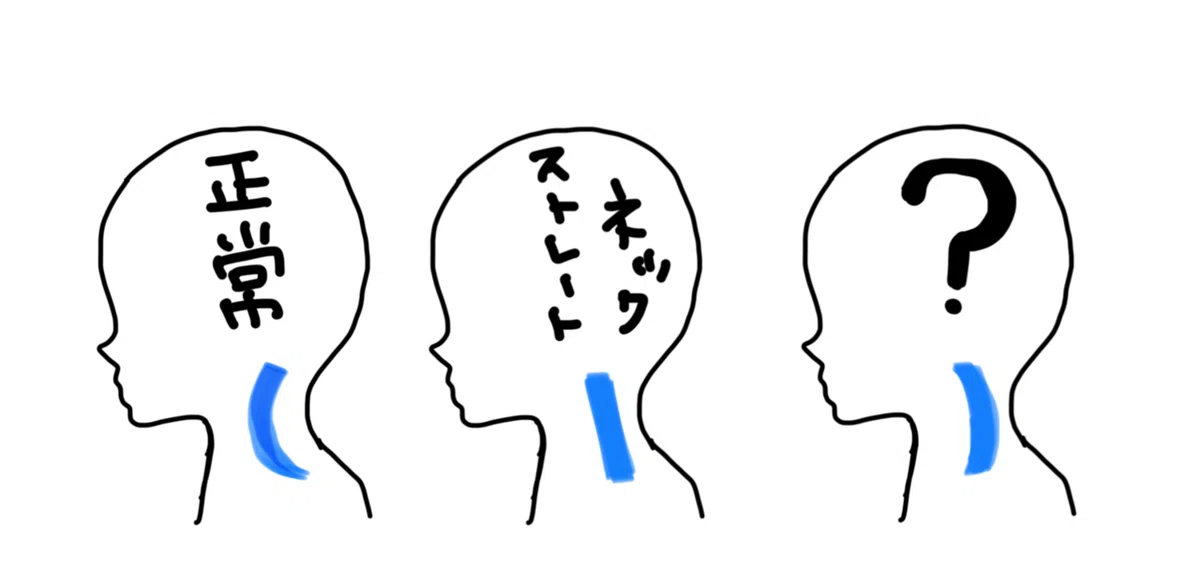 正常な首との比較