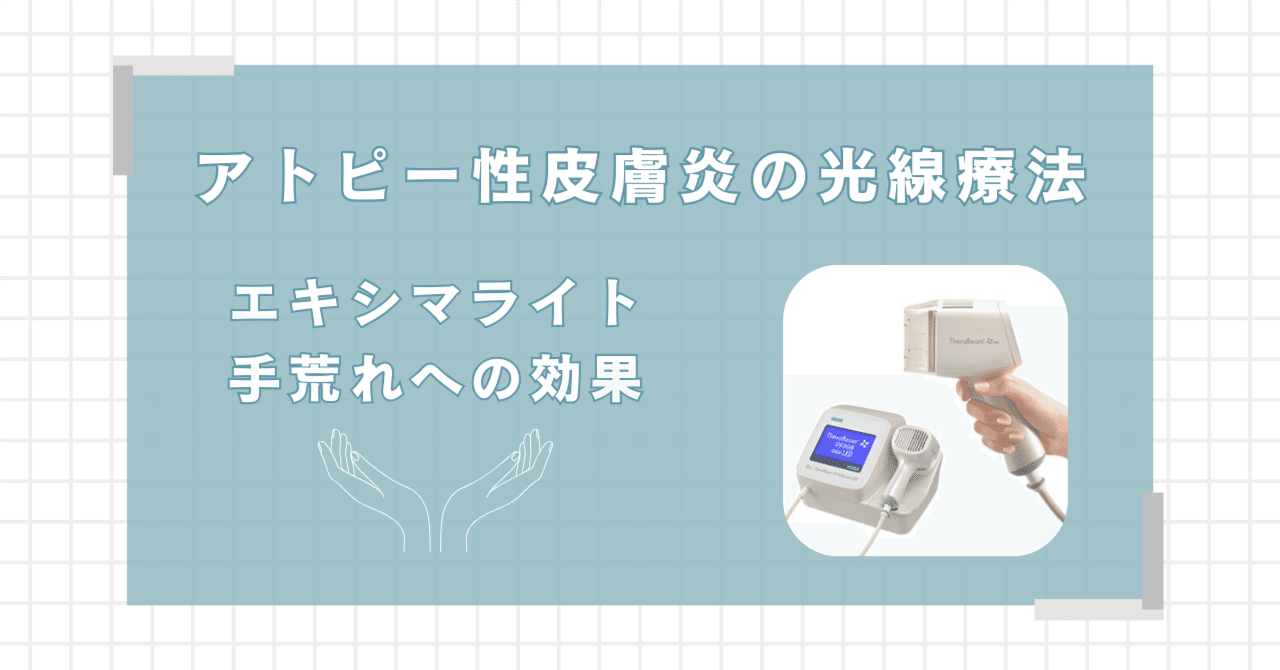 アトピー性皮膚炎の光線療法（エキシマライト）手荒れへの効果｜なな