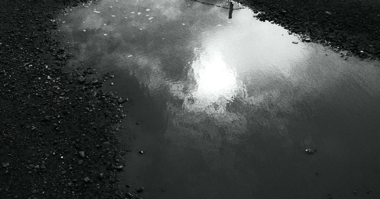 1 脳腫瘍 闘病の始まり ジル Note