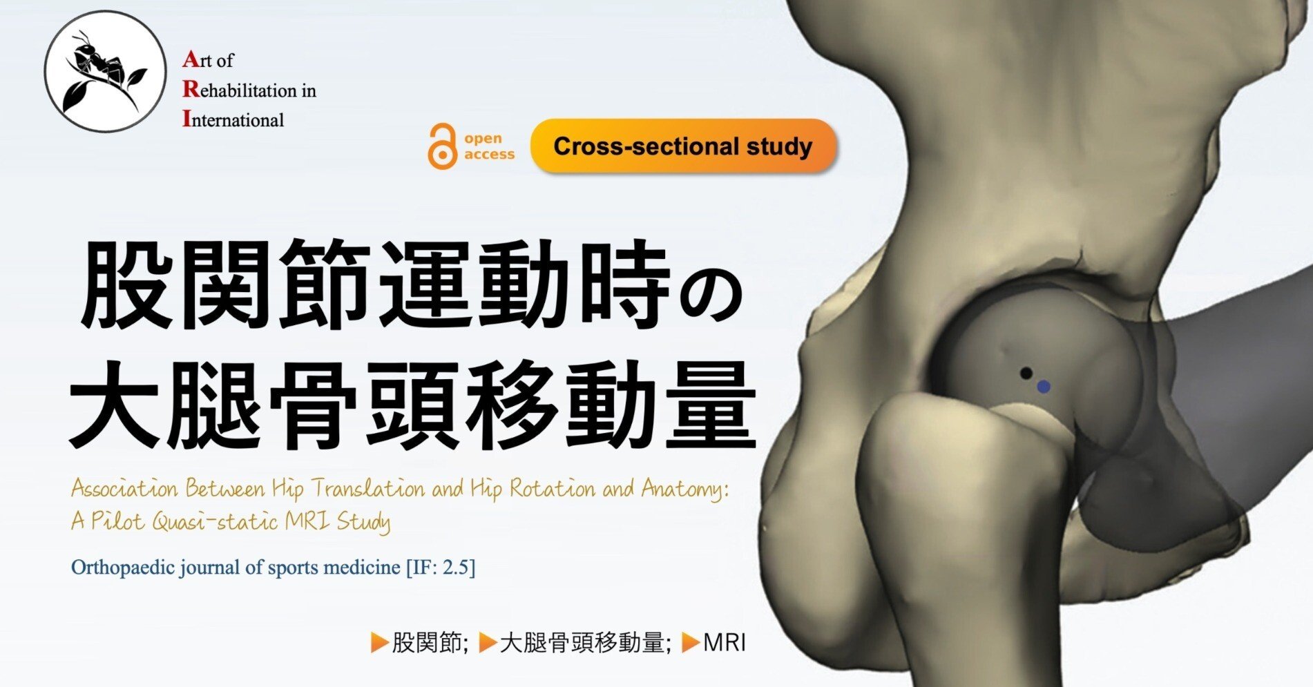 股関節運動時の大腿骨頭移動量｜Super Human | 理学療法士／保健
