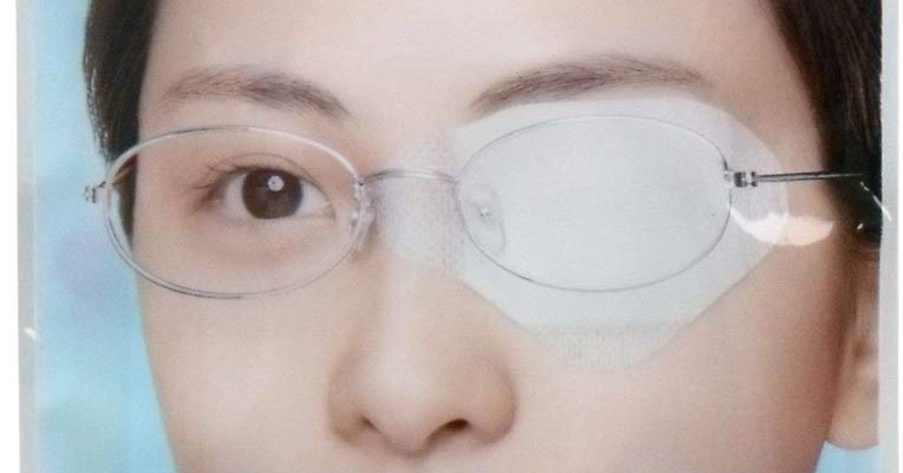 ものもらいに見る社会問題 日報 19 12 05 崇 Note