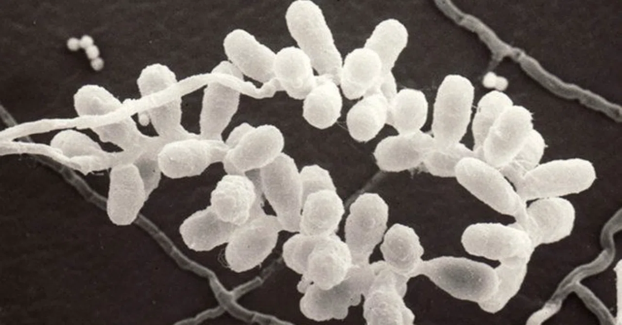 最新｜研究により、アレルギーおよび喘息患者の鼻腔真菌の多様性が明らかに