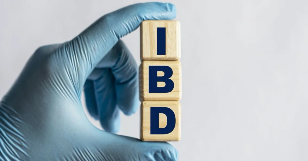 ビタミンDの血中濃度を高く維持することで炎症性腸疾患（IBD）をコントロール