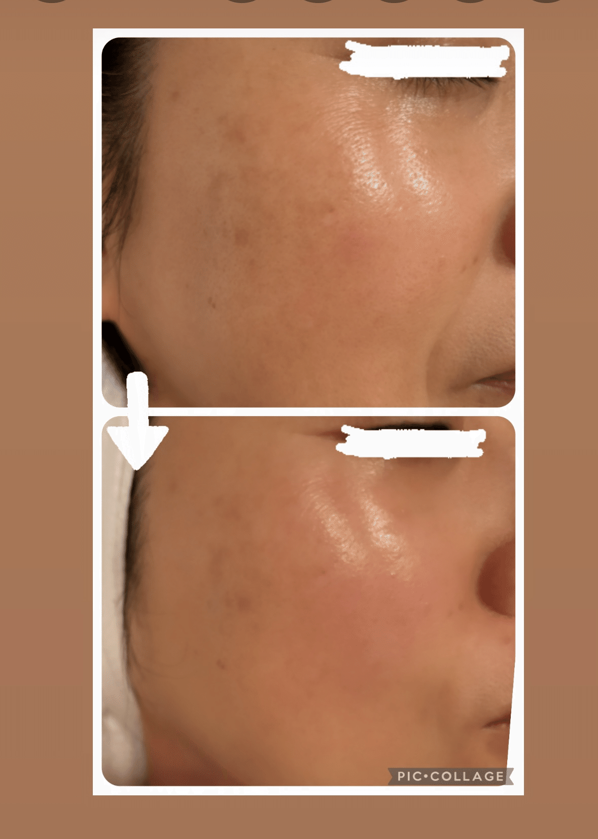 菅貞子 KANコルギセラピー 石膏パックセット