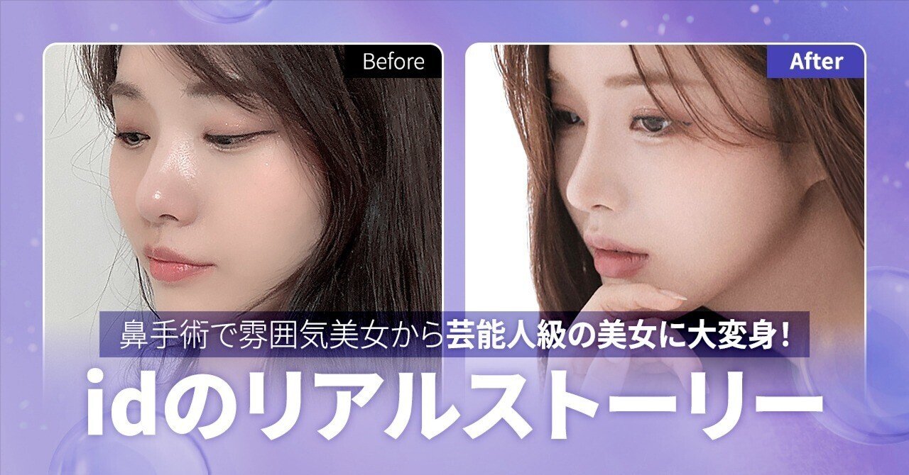 鼻手術で雰囲気美女から芸能人級の美女に大変身！idのリアルストーリー！｜[公式] id美容外科, image size:1280x670