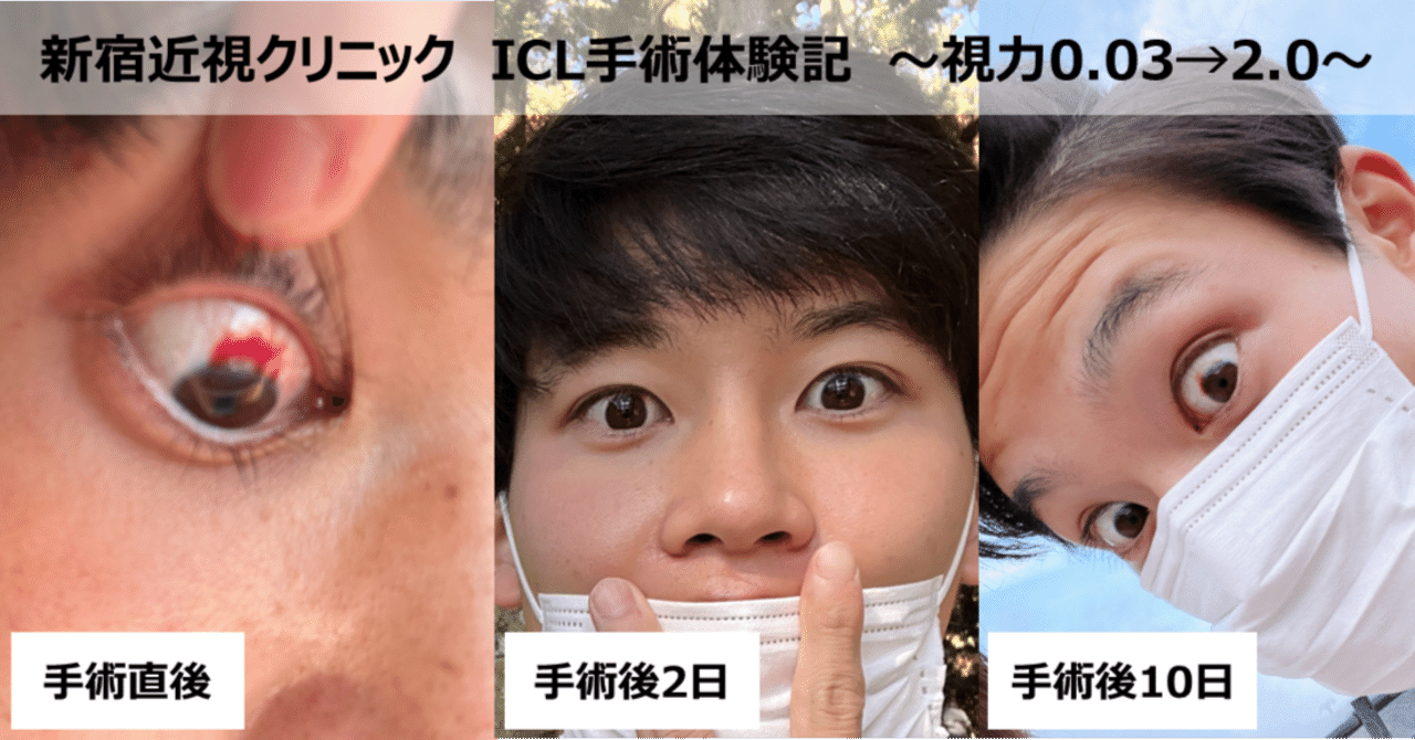 【中古】 近視手術体験レポート 最先端医療が安全・確実に視力をよみがえらせる/現代書林/恵比寿視力回復研究所 体験談】ICL手術で視力を0.03→2.0に魔改造した話@新宿近視