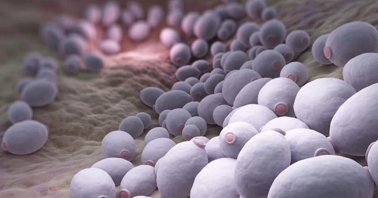 小腸真菌過剰増殖症 (Small Intestinal Fungal Overgrowth, SIFO)