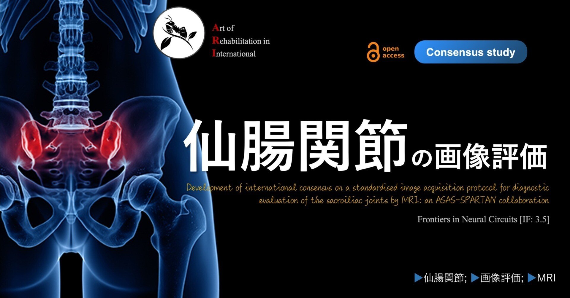 仙腸関節の画像評価｜Super Human | 理学療法士／保健学博士 Ph.D.