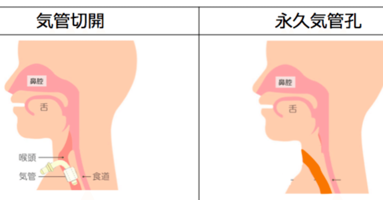 初めての気道管理 Yukika Note