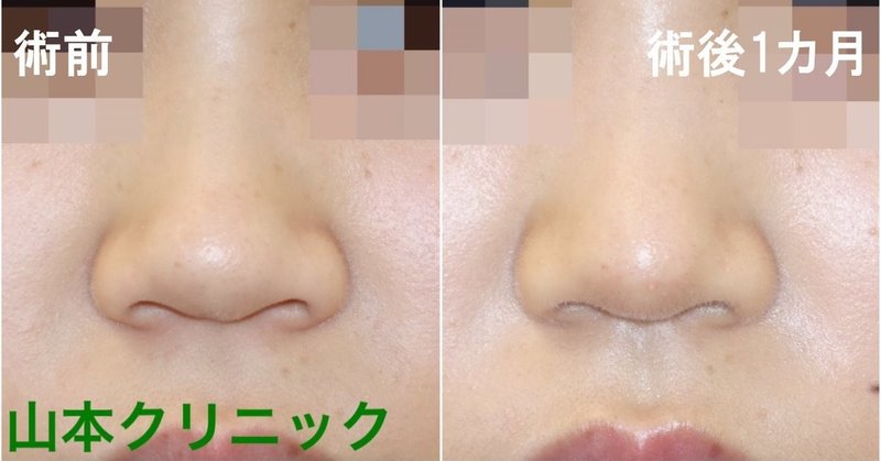 鼻を高くする の新着タグ記事一覧 Note つくる つながる とどける 鼻を高くする の新着タグ記事一覧 Note つくる つながる とどける