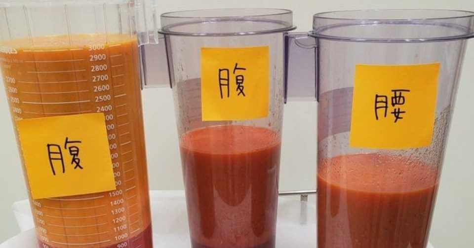 脂肪吸引で8 000cc取れた の真実 福田越の美容豆知識 福田越 Note