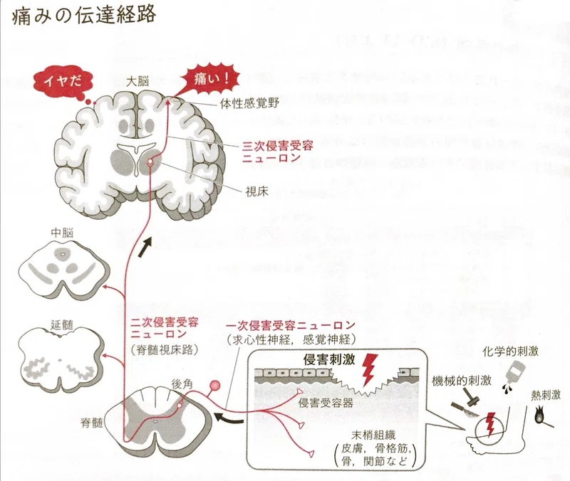 痛みに打ち勝て！〜手術後の痛みがひどくて、日常生活に支障が出ている人に。勝負の3日目とは〜｜けんす＠【即日体感】脳の機能解剖