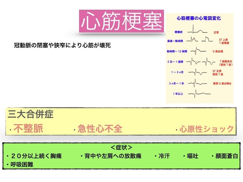 狭心症.004