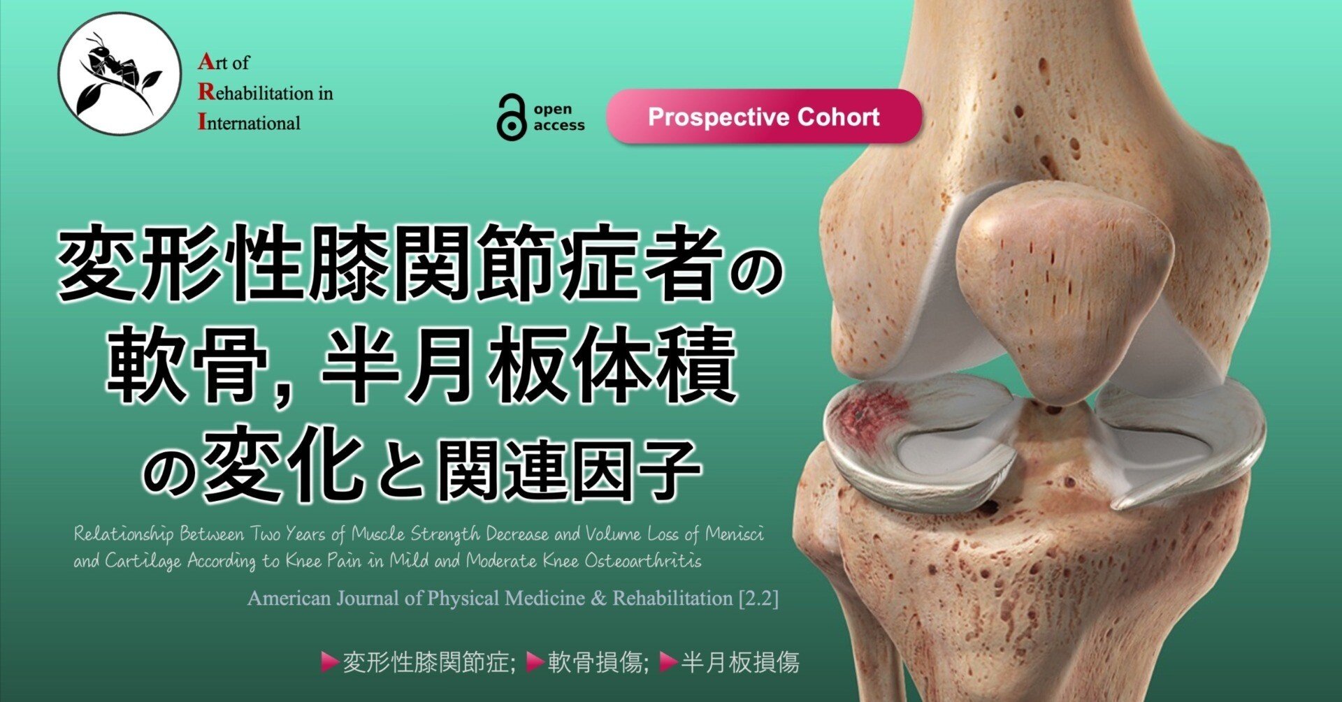 膝OA者の軟骨・半月板体積の変化と関連因子｜Super Human | 理学