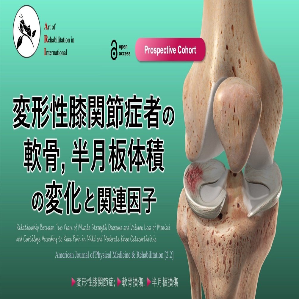 膝OA者の軟骨・半月板体積の変化と関連因子｜Super Human | 理学療法士