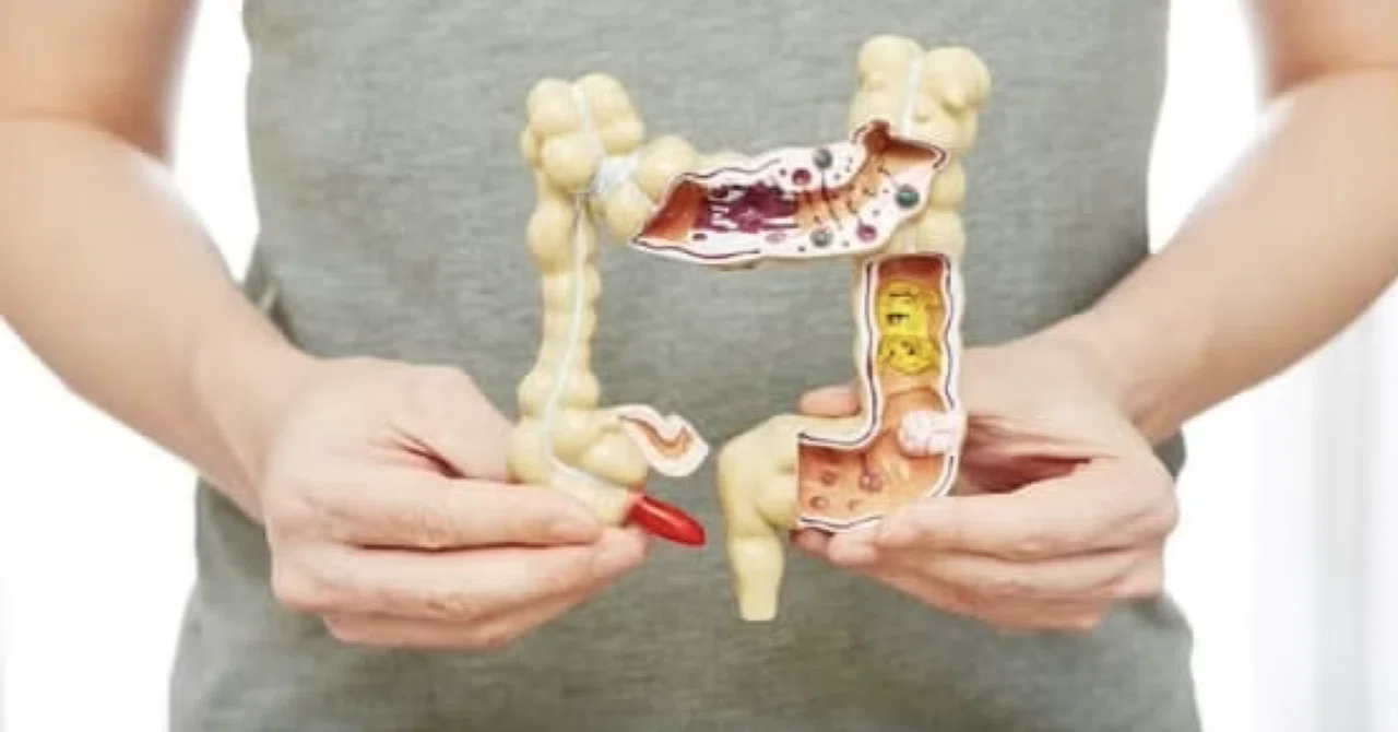 最新｜便秘が「大腸がんリスク」であるとは、実は証明されていなかった...もっと心配すべき「フレイル」とは何か？