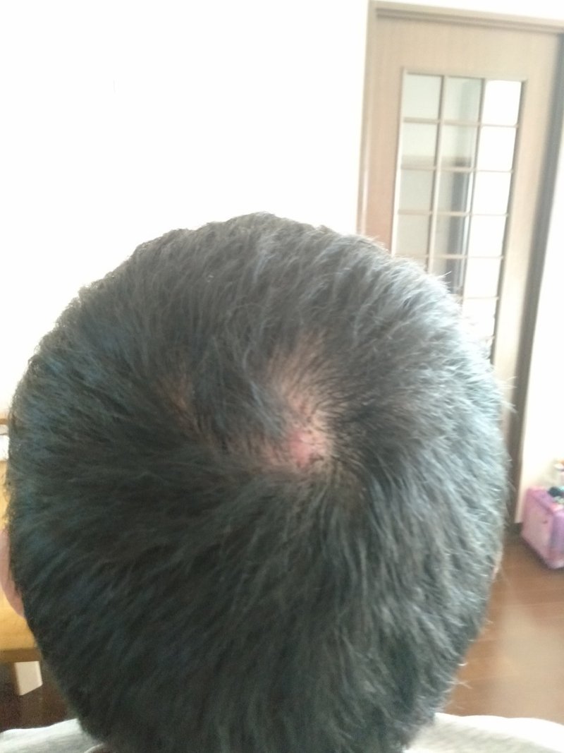 スーパーミリオンヘアーを使ってみた 中村 哲人 Note スーパーミリオンヘアーを使ってみた 中村 哲人 Note