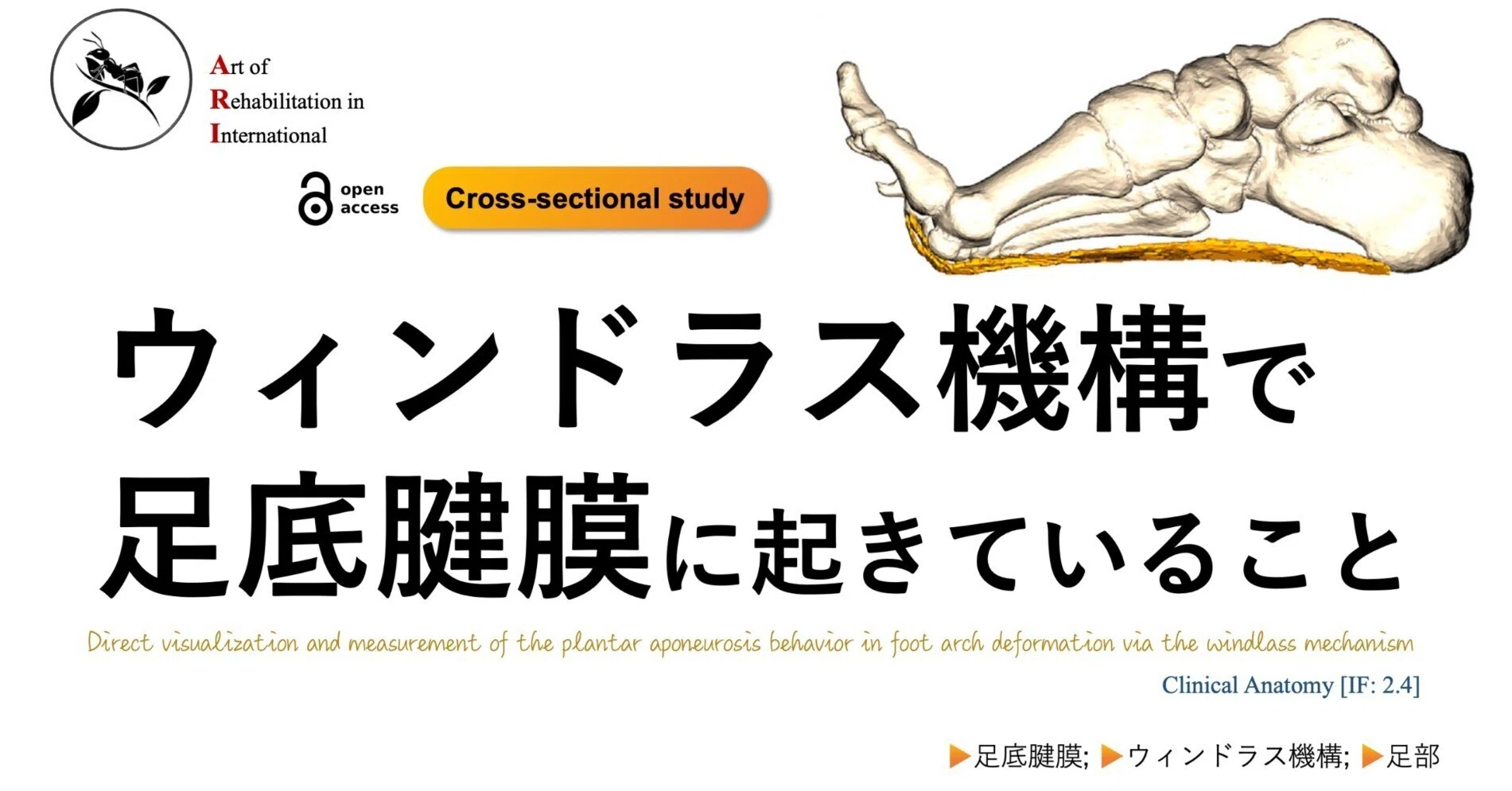 ウィンドラス機構で足底腱膜に起きていること|Super Human | 理学療法 ウィンドラス機構で足底腱膜に起きていること|Super Human | 理学療法