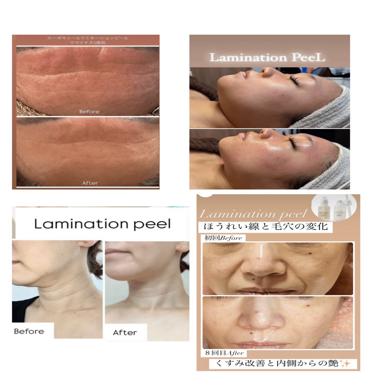 新メニュー！ラミネーションピールとは｜友野ユリア