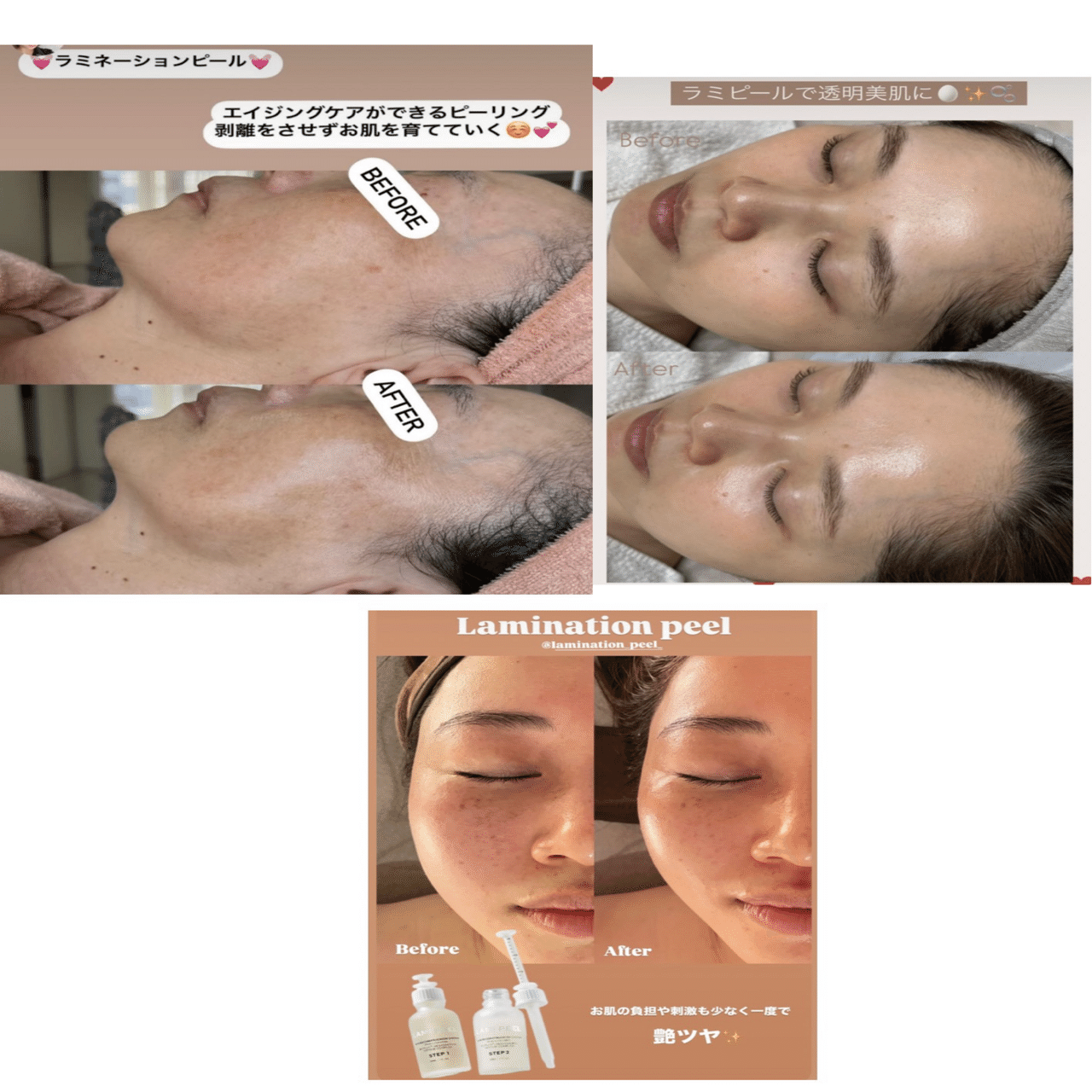 ラミネーションピール/10回分/ラミピール/剥けないピーリング/ハリとツヤ！ ラミネーションピール/ラミピール/剥けないピーリング/10回分/艶のある