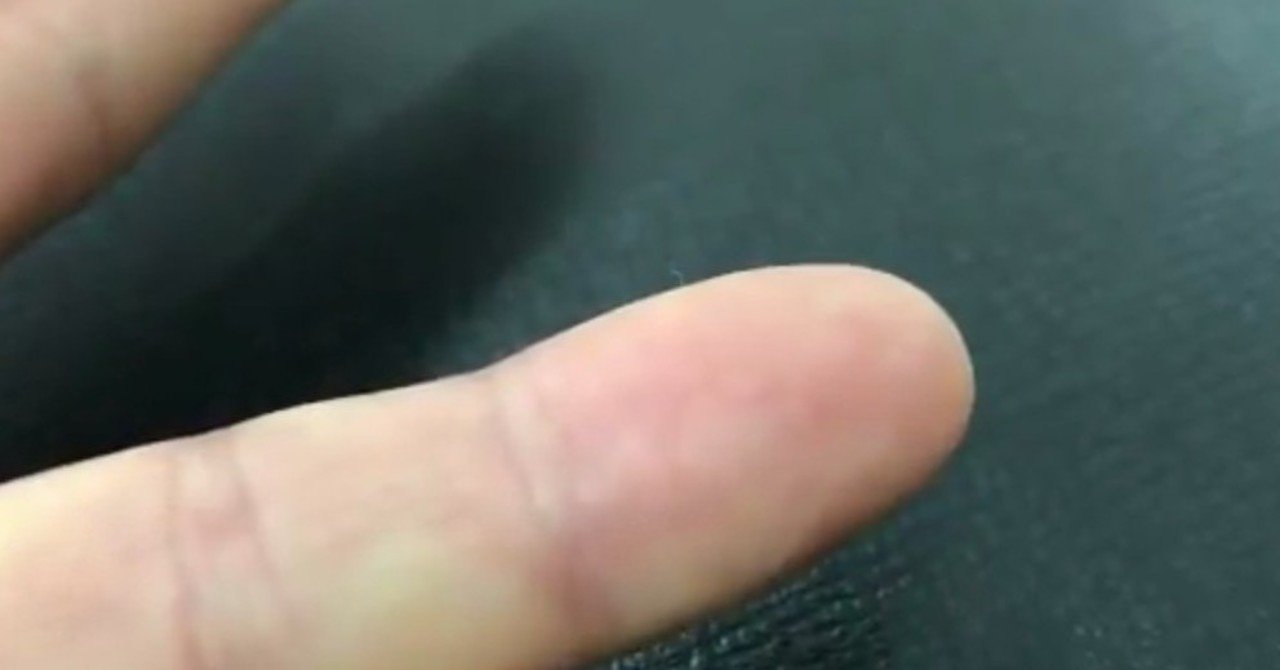 疳の虫 疳の虫
