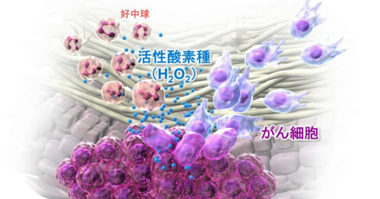 最新｜「毒」から逃げろ、がん転移の始まりの一端を解明