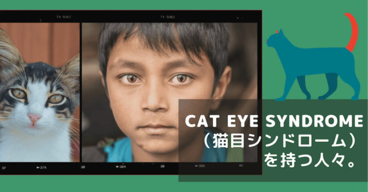 5万人に1人】猫の目を持つ人間「キャットアイ症候群」の人々。｜ぱや