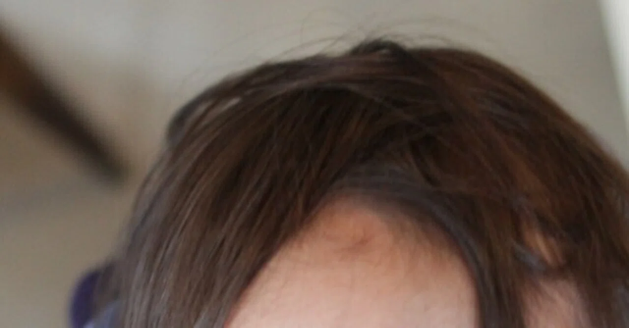 There's a Cowlick on My Forehead [2024.3.7]｜里山保育やまぼうしのブログ