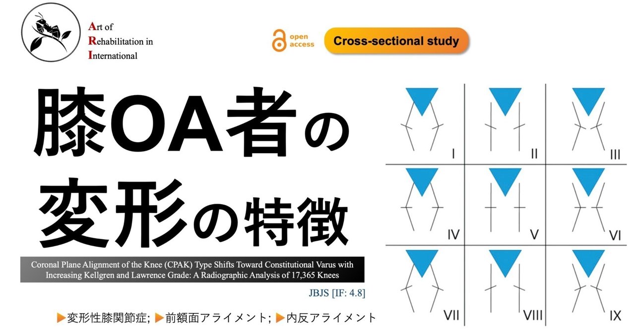 膝OAのマーカー確認 膝OA者の変形の特徴｜Super Human | 理学療法士／保健学博士 Ph.D.