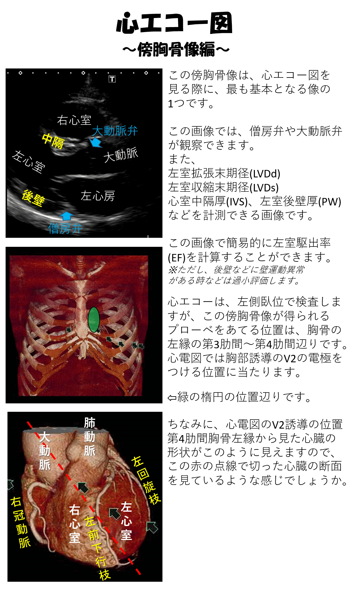心エコー図 傍胸骨像編 ぬるまゆ Note 心エコー図 傍胸骨像編 ぬるまゆ Note