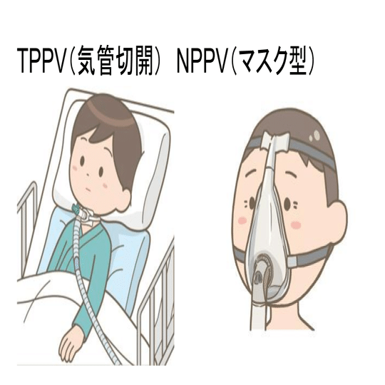 人工呼吸器の安全 確実な電源確保 増子邦行 Note